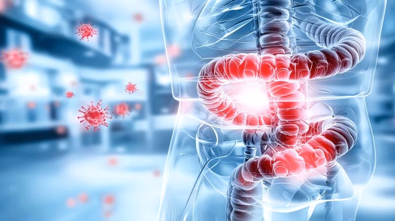 infliximab ulcerative colitis