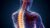 Ankylosing Spondylitis